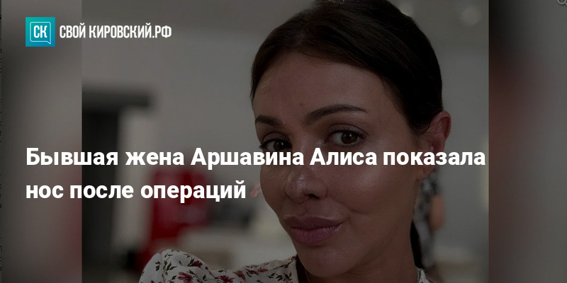 Бывшая жена Аршавина Алиса показала нос после операций