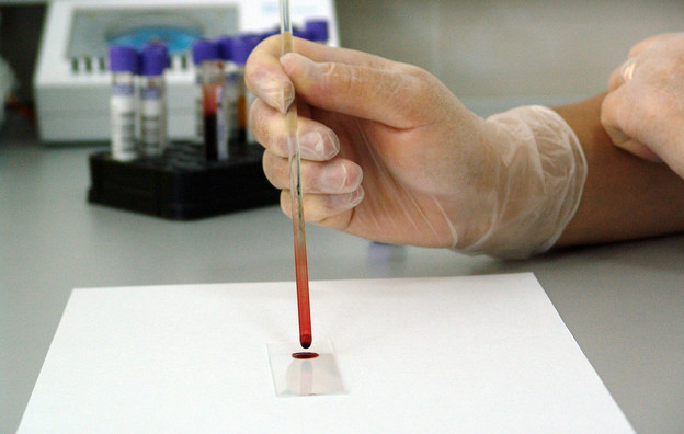 Общий и биохимический анализ крови