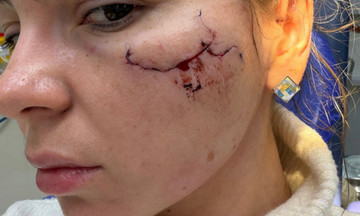 МВД Татарстана подтвердило факт нападения на кировчанку в клубе Казани