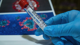 В Кировской области ещё 67 человек заразились коронавирусом