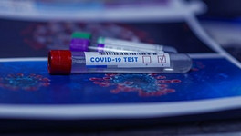 В Кировской области ещё 112 человек заразились коронавирусом