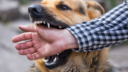 В Кировской области районная администрация заплатит за укус ребёнка собакой