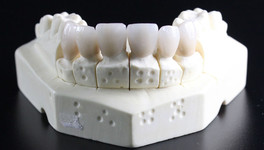 Кому положены льготы на протезирование зубов?