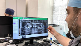 В Кирове стоматолог-хирург удалил мужчине новообразование, развивавшееся более двух лет