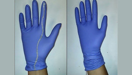 В Лондоне учёные создали сенсорную перчатку для обследования рожениц