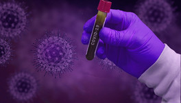 Рекордный прирост заразившихся: коронавирус обнаружили ещё у 40 жителей Кировской области