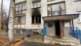 В Кирове в пожаре пострадала женщина