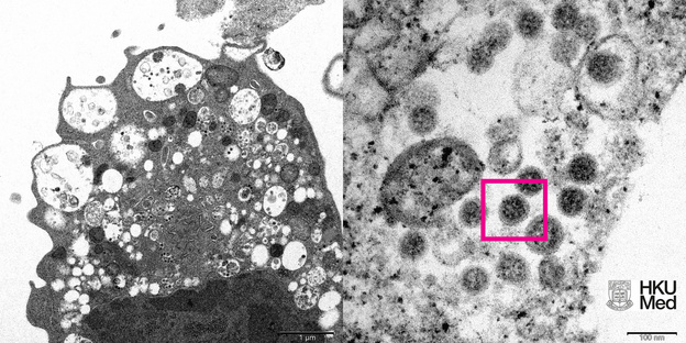 В Китае учёным удалось запечатлеть на фото омикрон-штамм коронавируса