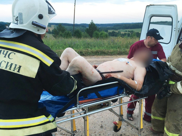 В Кирово-Чепецке из ноги мужчины, попавшего в ДТП, вытащили 80-сантиметровую арматуру