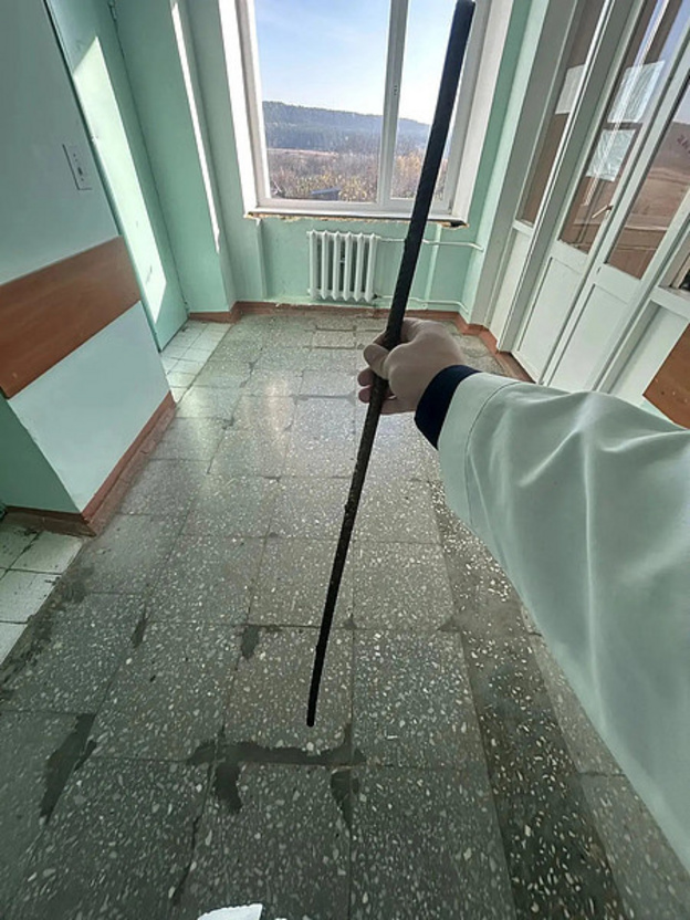 Хирурги Уржумской ЦРБ спасли мальчика после падения на металлический штырь