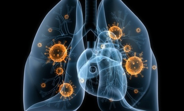 Коварная пневмония: как вовремя распознать заболевание?