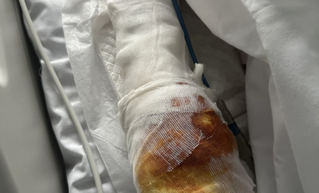 Состояние пострадавшего от взрыва в Красногорске остаётся средней тяжести