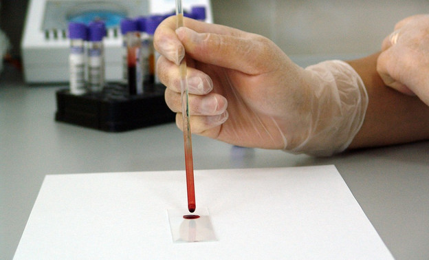 Кировчане смогут бесплатно пройти экспресс-тестирование на ВИЧ