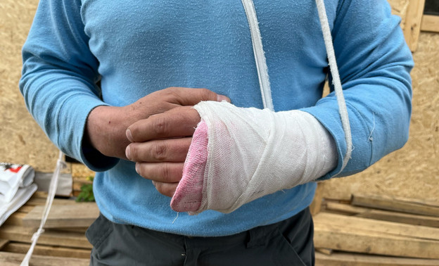 В Стрижах мужчина получил серьёзные травмы после нападения ротвейлера