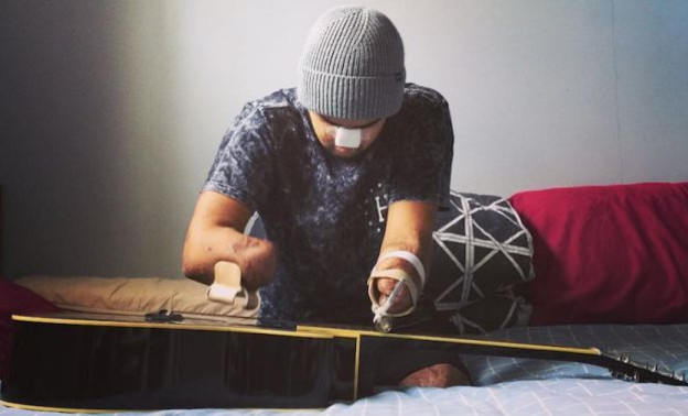 Новозеландец после ампутации кистей рук играет на гитаре