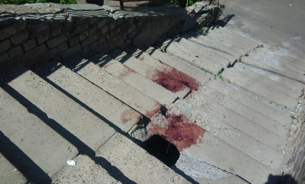 Кировчанин упал на лестнице и разбил голову