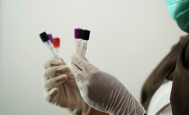 В Кировской области за сутки коронавирусом заболели 125 человек