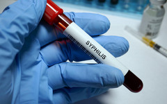 Что такое сифилис и как им можно заразиться?