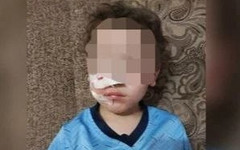 Бесхозная собака искусала ребенка: прокуратура взыскала 100 тысяч рублей