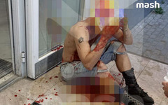 Жителю Электростали сняли скальп из-за вызывающей причёски