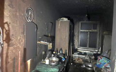 В Слободском мужчину госпитализировали после возгорания телевизора