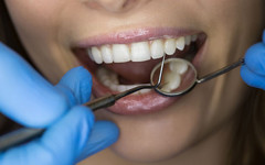 Художественная реставрация зуба: что это и сколько стоит