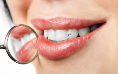 Бриллианты на зубах: что такое скайсы и насколько они безопасны?